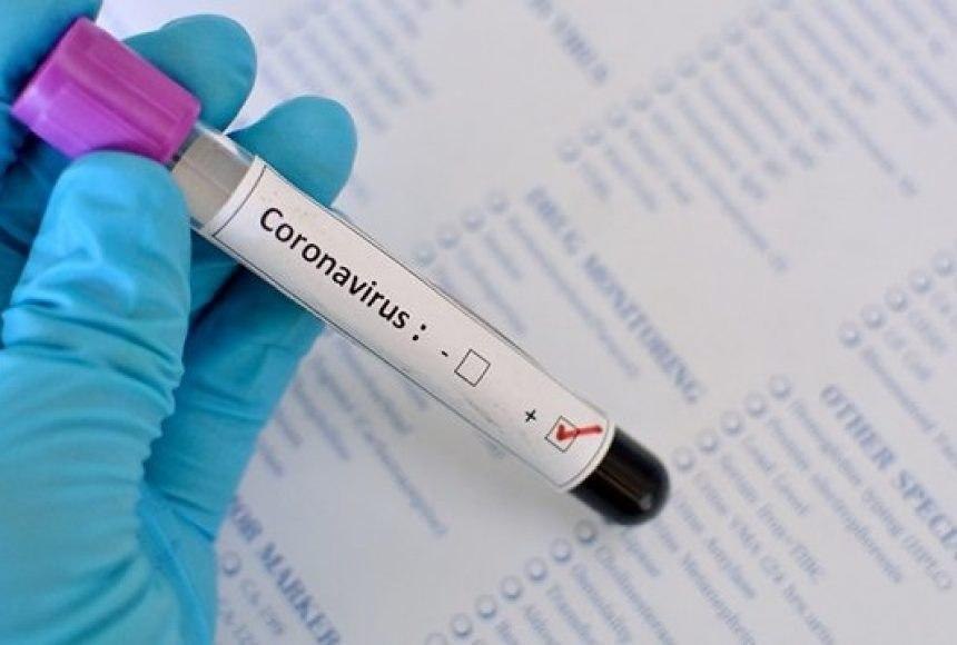 Ўзбекистонда коронавирус инфекцияси билан оғриган беморлар сони 2 минг 233 тага етди