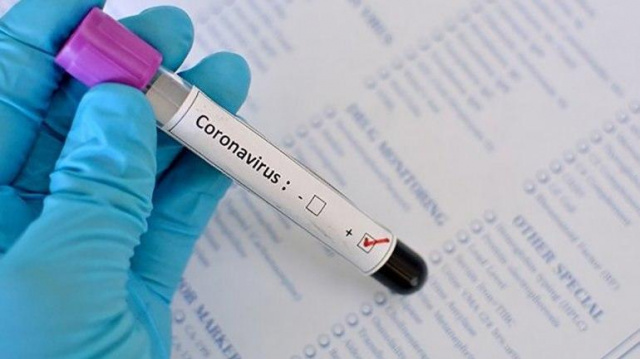 Coronavirus in Uzbekistan: 42,370 cases